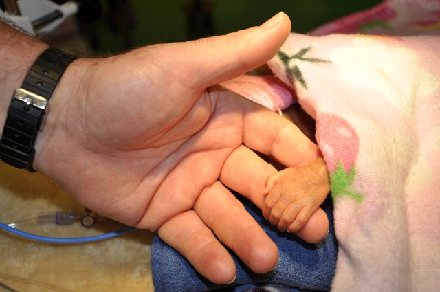 the smallest patient in Tonga is in the surgeon's hands