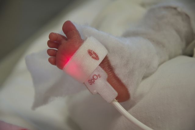 nurses monitoring the smallest cardiac patient in Tonga